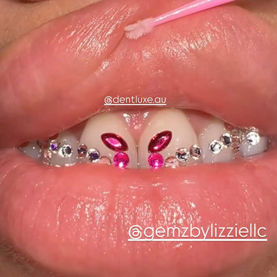 Butterfly Set Tooth Gems