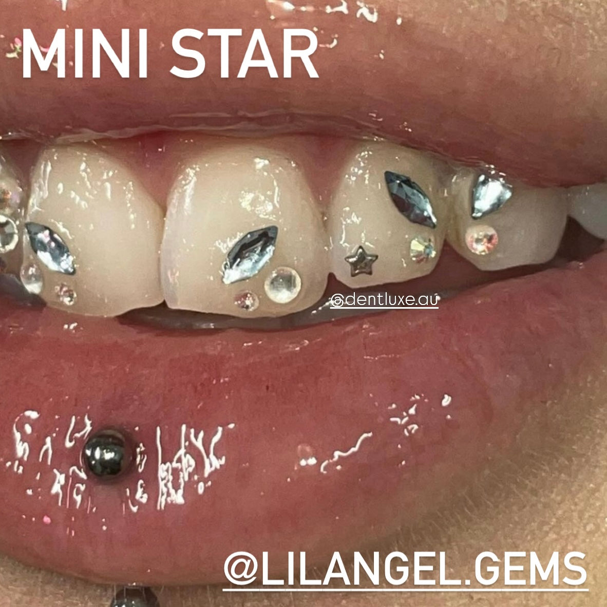 18k Gold Tooth Gem STAR