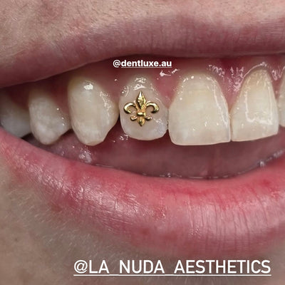 18k Gold Tooth Gem FLEUR DE LIS