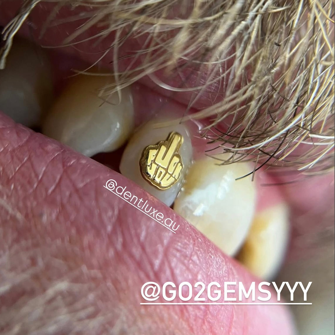 18k Gold Tooth Gem F U FINGER