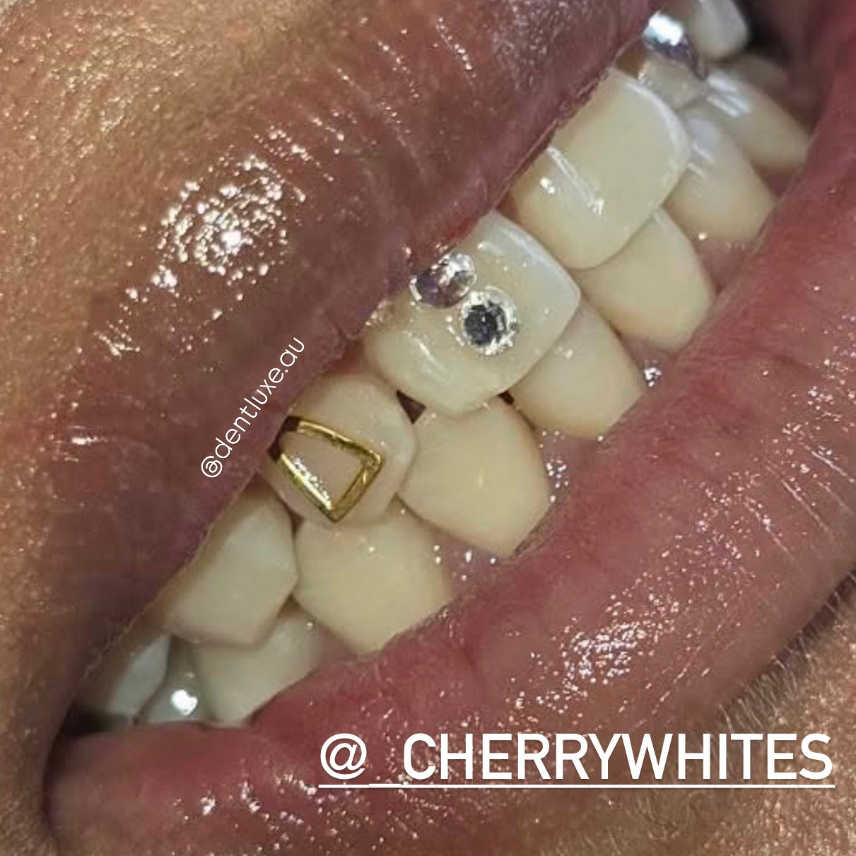18k Gold Tooth Gem OUTLINE BAR CAP NIFO KOULA