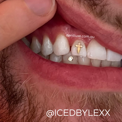 18k Gold Tooth Gem CROSS