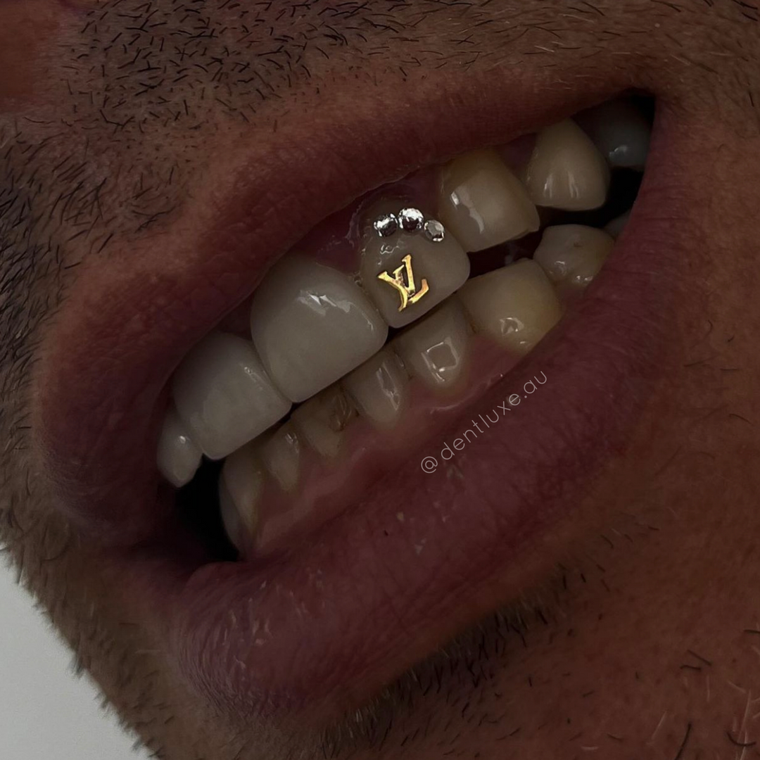 18k Gold Tooth Gems LV Dentluxe