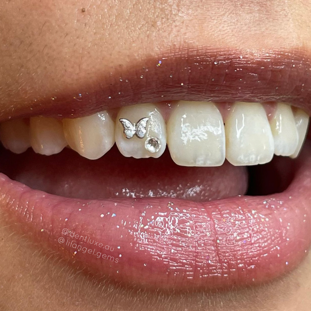 Designer tooth gems online